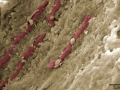 Dentine imaged with an SEM