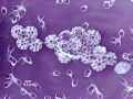 Brochosomes on filter imaged with a TEM