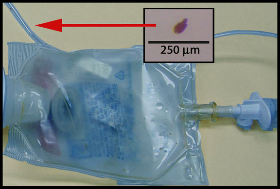IV bag with contaminant