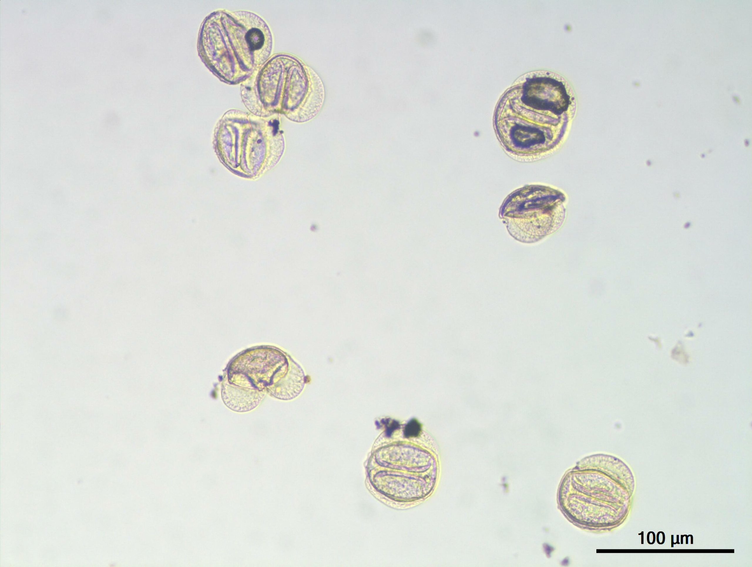 Tree Pollen Under A Microscope