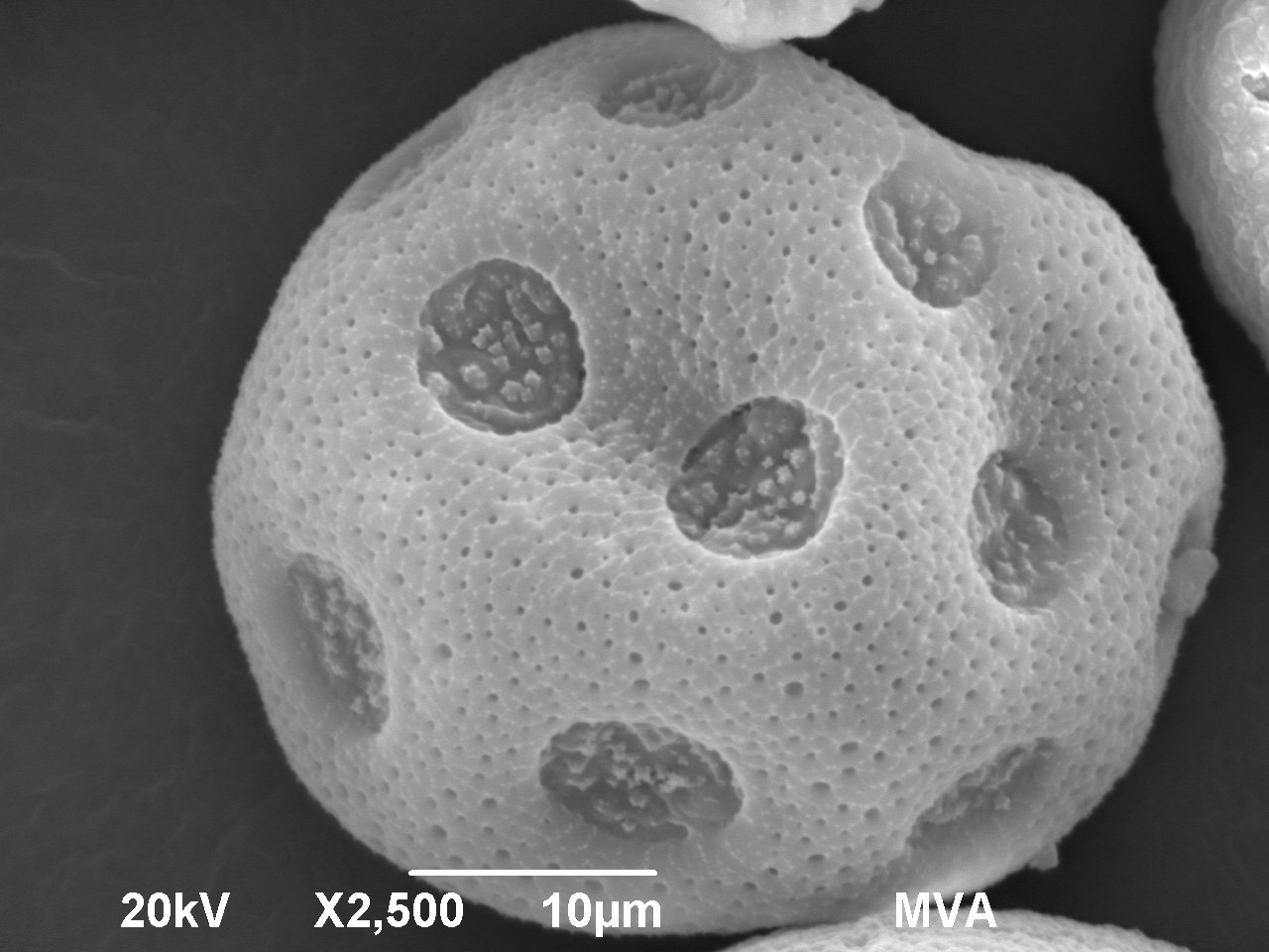 scanning electron micrograph of sweetgum pollen particle 