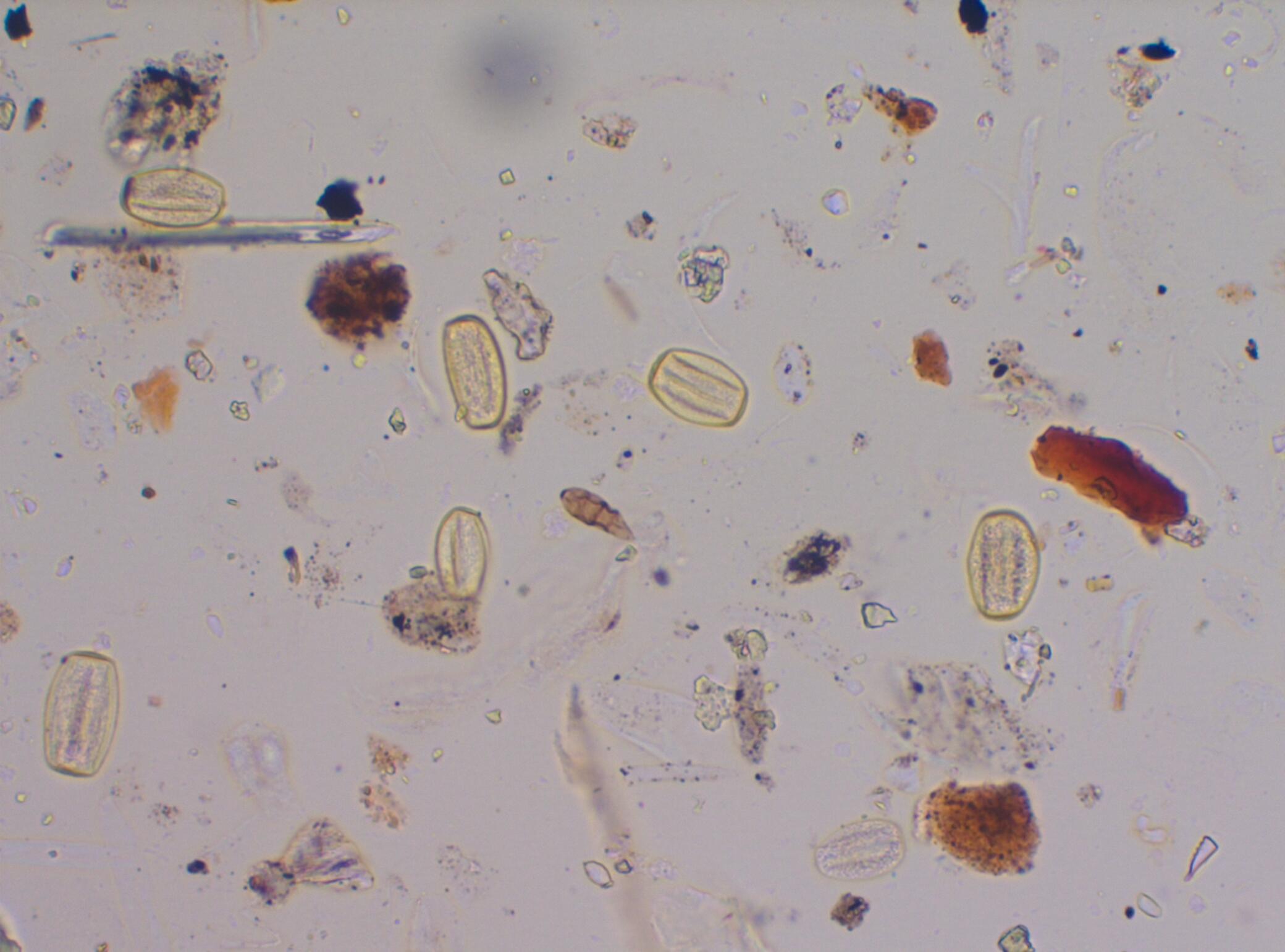 Environmental Forensics - Pollen Imaged by PLM